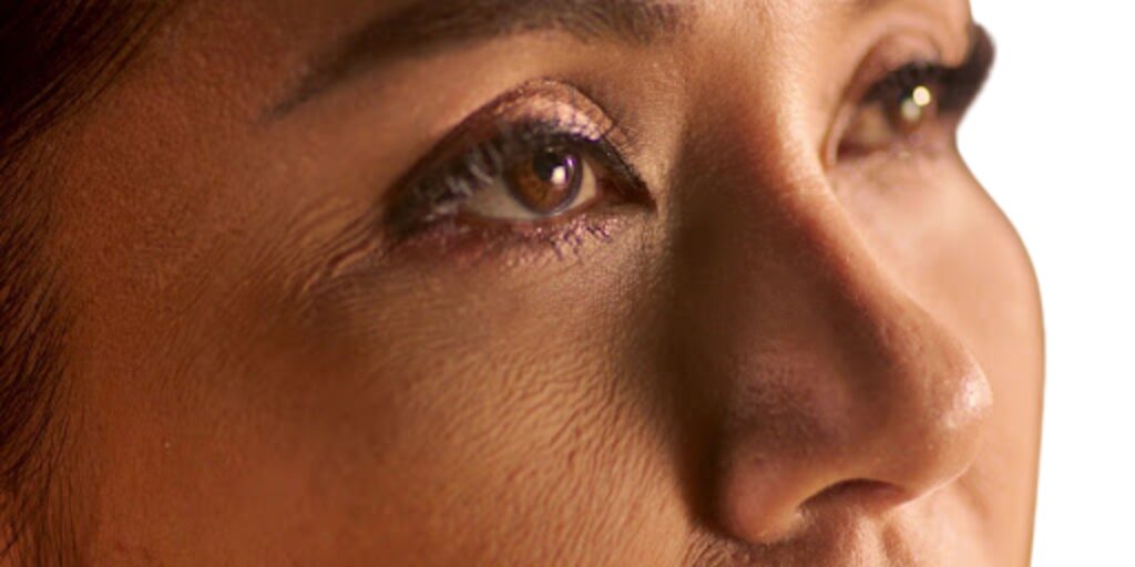 Karisma là gì? Tiêm BAP Karisma giá bao nhiêu? 5 Ai nên tiêm BAP Karisma RH Collagen