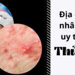 Địa chỉ lấy nhân mụn uy tín Thủ Đức thumbnail