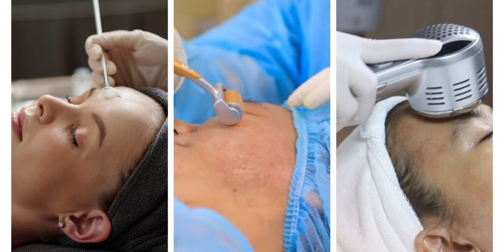 Peel da trị mụn giá bao nhiêu? Hiệu quả và lưu ý trước khi thực hiện 7 Gợi ý địa chỉ peel da trị mụn uy tín tại TP. HCM