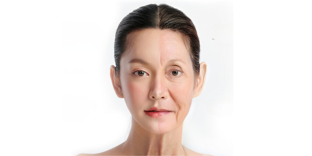 Tiêm Juvederm Volite giá bao nhiêu? Hiệu quả chống lão hóa da thế nào? 4 Juvederm Volite có công dụng gì cho da