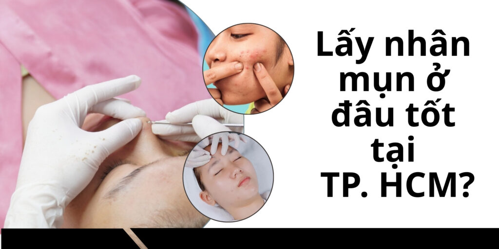 Lấy nhân mụn ở đâu tốt tại TP. HCM