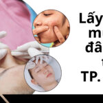 Lấy nhân mụn ở đâu tốt TP. HCM? Gợi ý địa chỉ uy tín cho làn da sạch mụn 6 Lấy nhân mụn ở đâu tốt tại TP. HCM
