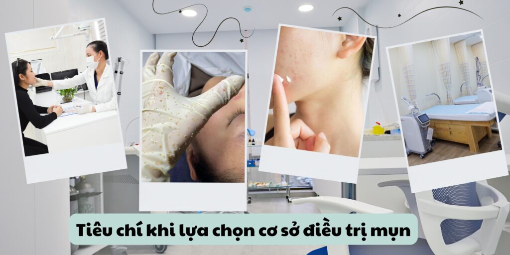 Trị mụn bằng laser giá bao nhiêu? Gợi ý địa chỉ trị mụn uy tín TP. HCM 6 Lời khuyên khi lựa chọn cơ sở điều trị mụn