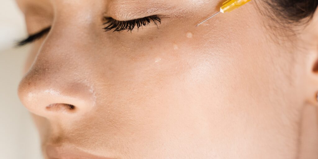 Tiêm Juvederm Volite giá bao nhiêu? Hiệu quả chống lão hóa da thế nào? 8 Lưu ý trước và sau khi tiêm Juvederm Volite