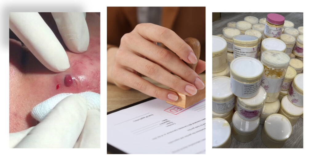 Địa chỉ lấy nhân mụn uy tín Thủ Đức: Chi phí và quy trình như thế nào? 9 Những lưu ý để tránh các spa nặn mụn kém chất lượng tại Thủ Đức