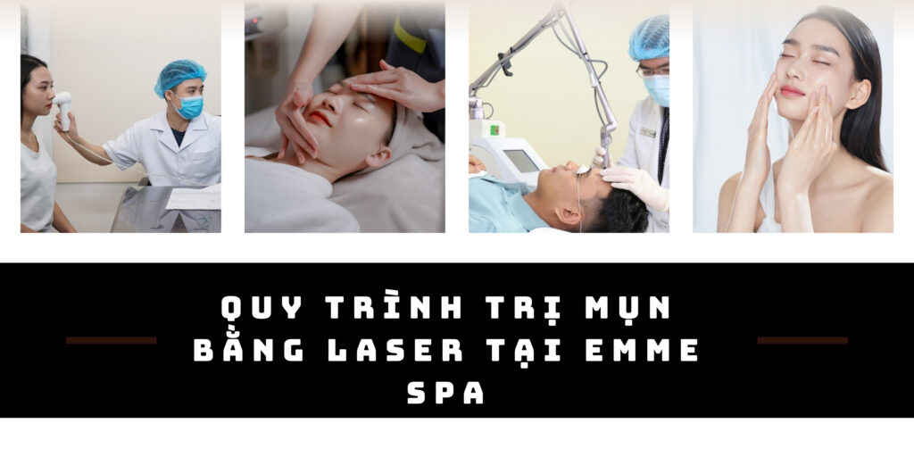 Trị mụn bằng laser giá bao nhiêu? Gợi ý địa chỉ trị mụn uy tín TP. HCM 4 Quy trình điều trị mụn bằng laser chuẩn y khoa tại Emme Beauty & Spa