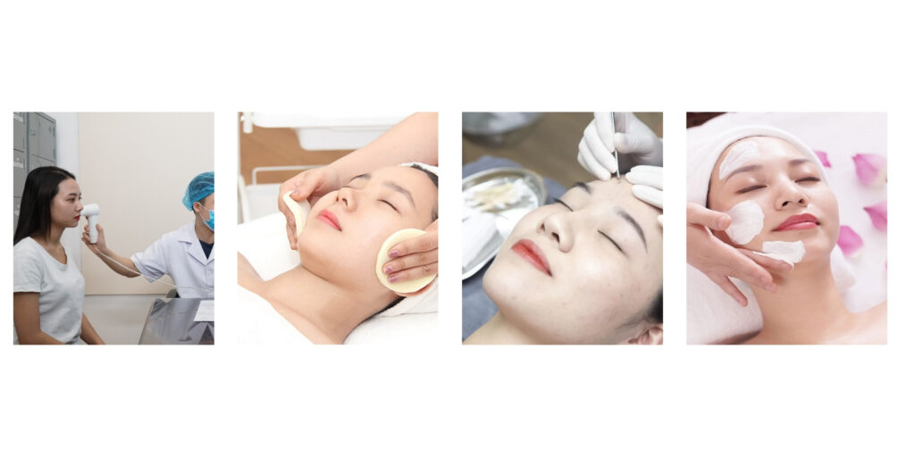 Quy trình lấy nhân mụn chuẩn y khoa tại Emme Beauty & Spa