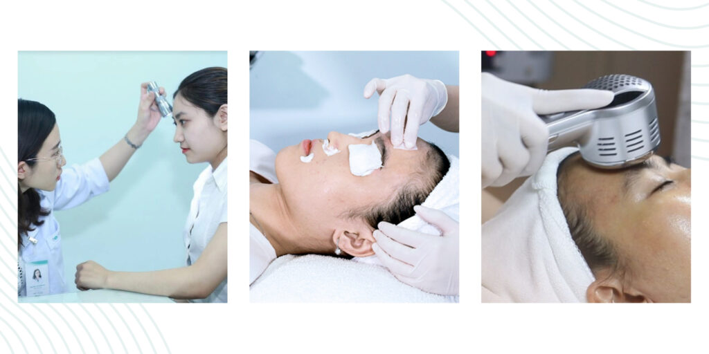 Peel da trị mụn giá bao nhiêu? Hiệu quả và lưu ý trước khi thực hiện 5 Quy trình peel da trị mụn