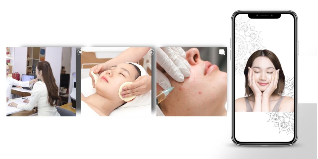 Karisma là gì? Tiêm BAP Karisma giá bao nhiêu? 6 Quy trình tiêm BAP Karisma RH Collagen tại Emme Beauty & Spa