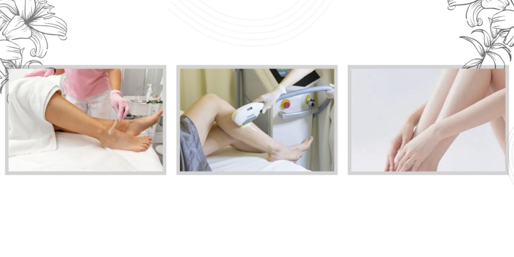 Triệt lông chân giá bao nhiêu? Bảng giá mới nhất 2025 5 Quy trình triệt lông chân chuẩn y khoa tại EMME Beauty & Spa