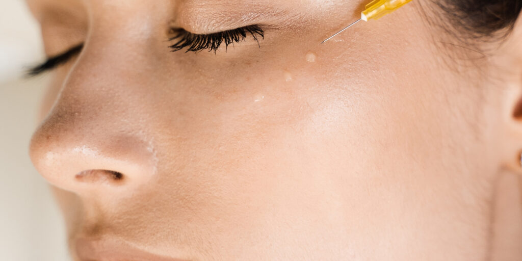 Tiêm skin booster Belotero Revive giá bao nhiêu? Hiệu quả trẻ hóa da thế nào? 3 Tiêm Belotero Revive giá bao nhiêu