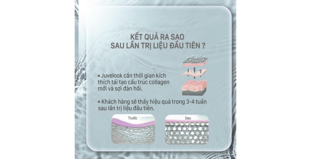 Tiêm meso Juvelook: Giá bao nhiêu và hiệu quả trẻ hóa da thế nào? 7 Tiêm Juvelook bao lâu thì thấy hiệu quả