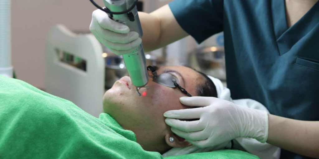 Trị mụn bằng laser giá bao nhiêu? Gợi ý địa chỉ trị mụn uy tín TP. HCM 2 Trị mụn bằng laser là gì