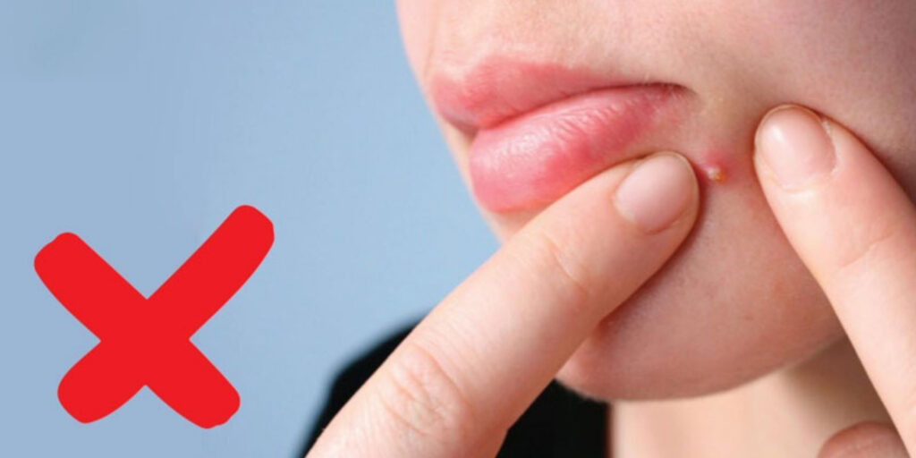 Địa chỉ lấy nhân mụn uy tín Thủ Đức: Chi phí và quy trình như thế nào? 8 Vì sao nên lấy nhân mụn