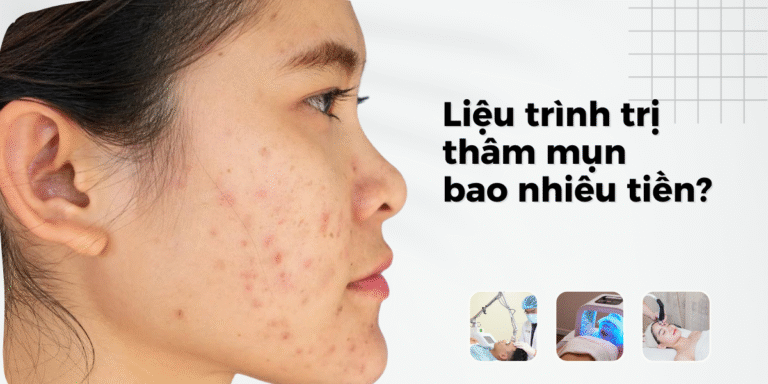 liệu trình trị thâm mụn bao nhiêu tiền