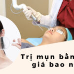 thumbnail Trị mụn bằng laser giá bao nhiêu