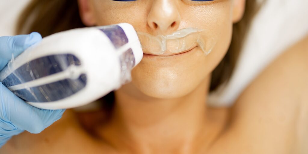 Triệt lông mép giá bao nhiêu? Gợi ý địa chỉ triệt lông uy tín tại TP. HCM 9 Bao lâu mới cần triệt 1 lần