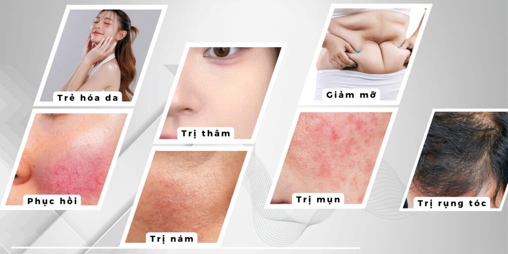 Các loại meso phổ biến phân theo mục tiêu điều trị