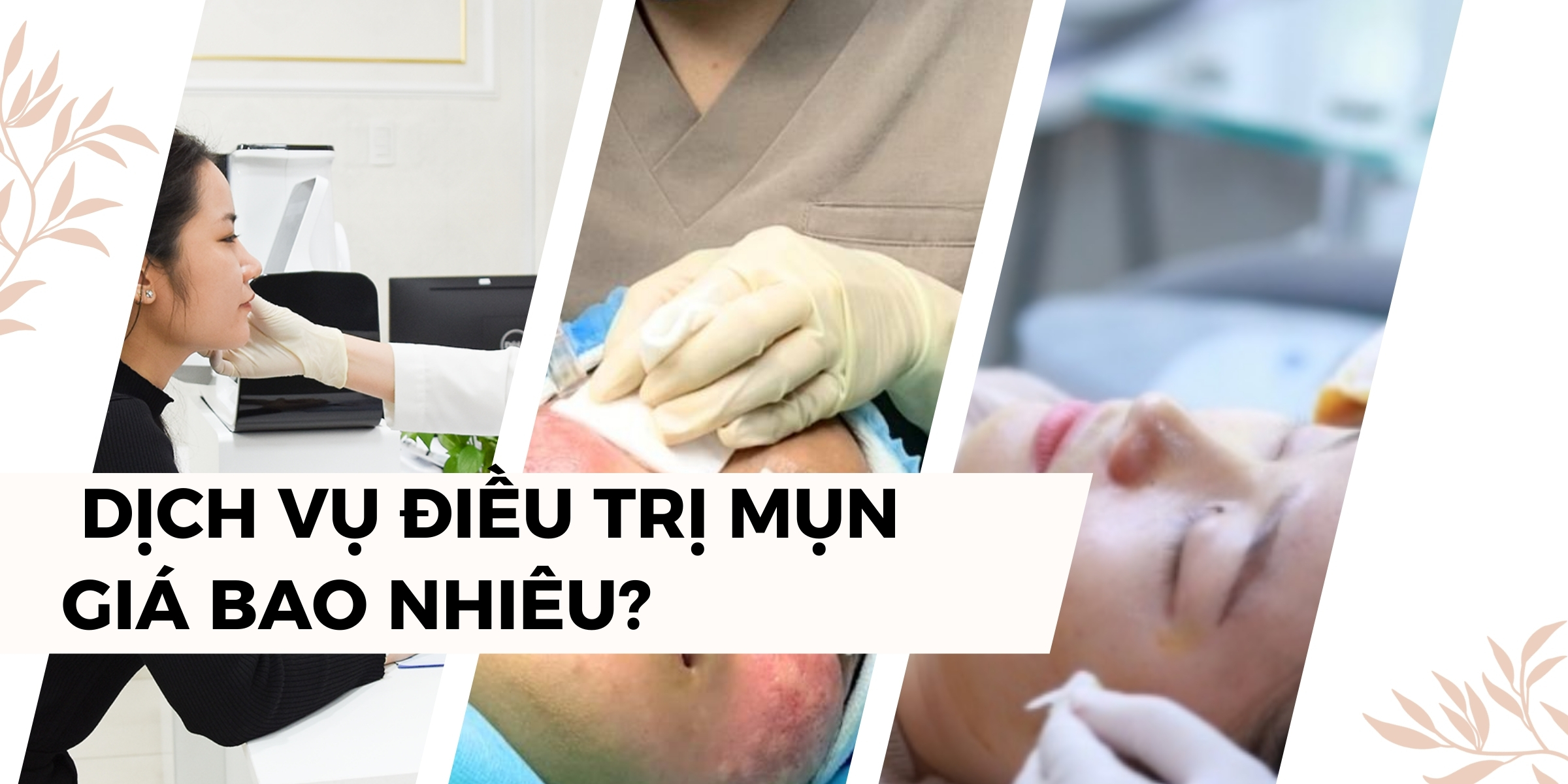 Dịch vụ điều trị mụn thumb
