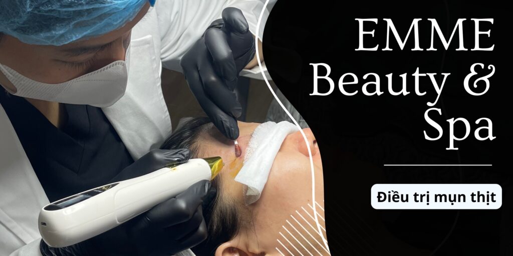 Điều trị mụn thịt thumb (1)