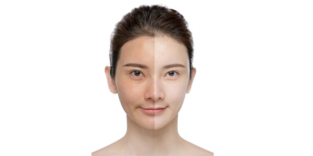 Đối tượng nên và không nên tiêm meso