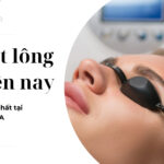 Giá triệt lông mày hiện nay là bao nhiêu thumb