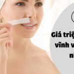 Triệt lông mép giá bao nhiêu? Gợi ý địa chỉ triệt lông uy tín tại TP. HCM 6 Giá triệt lông mép hiện nay là bao nhiêu