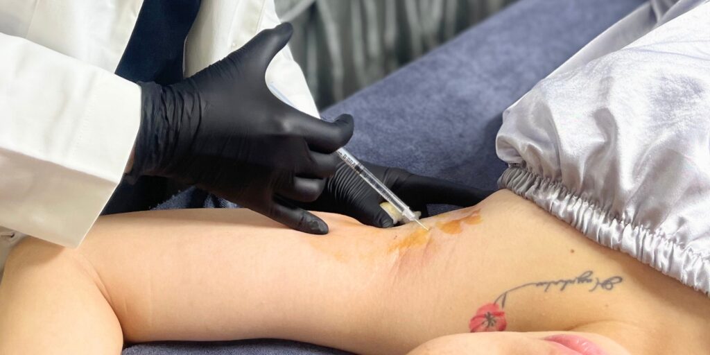 Tiêm botox trị hôi nách giá bao nhiêu và có hiệu quả thật sự không? 5 Gợi ý địa chỉ tiêm botox trị hôi nách uy tín tại TP. HCM