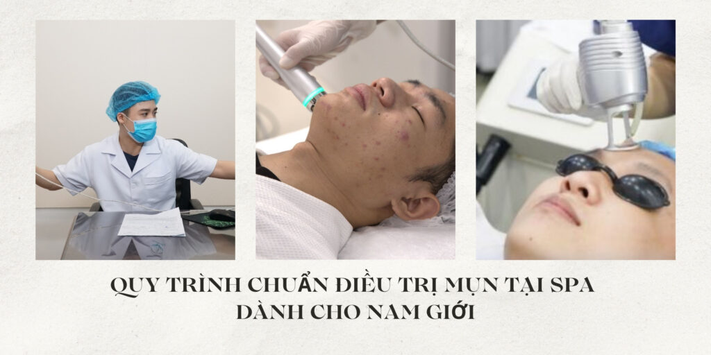 Quy trình chuẩn điều trị mụn tại spa dành cho nam giới