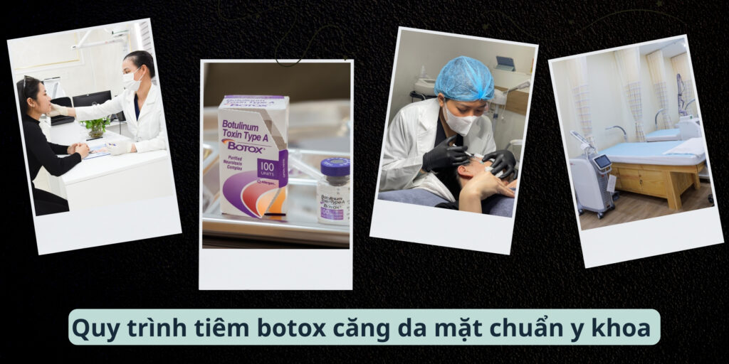 Tiêm botox căng da mặt giá bao nhiêu và hiệu quả ra sao? 2 Quy trình tiêm botox căng da mặt chuẩn y khoa tại EMME Beauty & Spa
