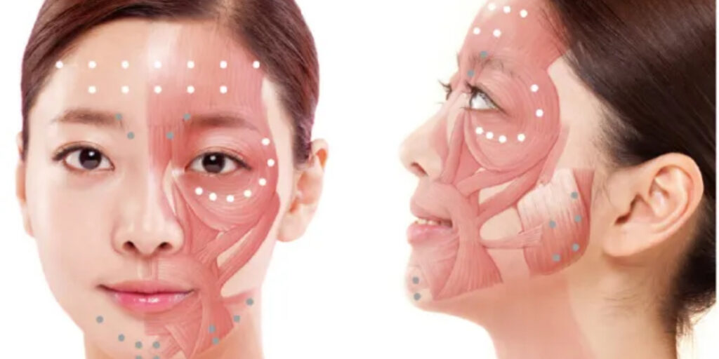Tiêm botox căng da mặt giá bao nhiêu và hiệu quả ra sao? 4 Tiêm botox căng da mặt có rủi ro nào không