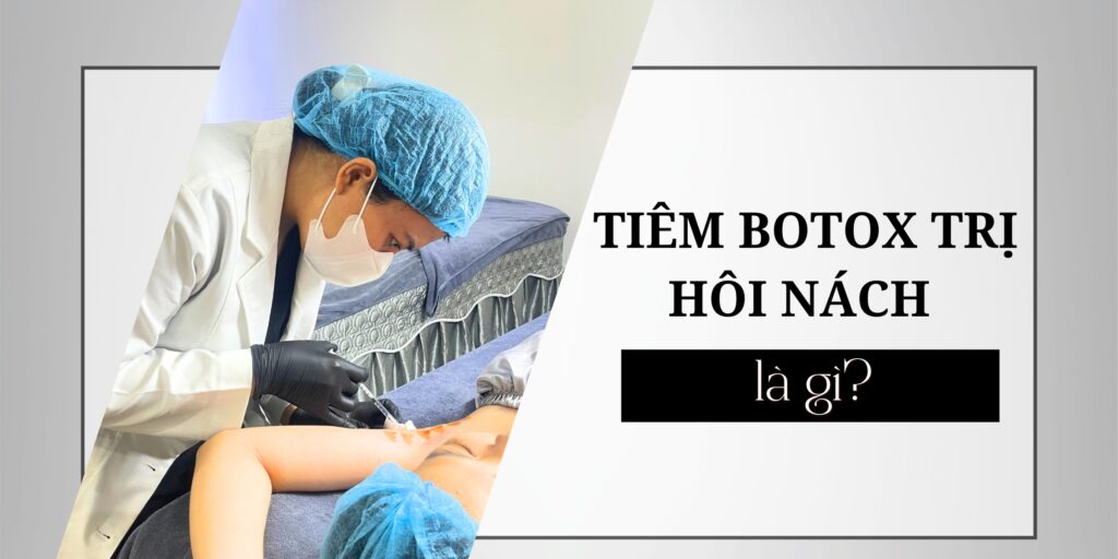 Tiêm botox trị hôi nách là gì thumb
