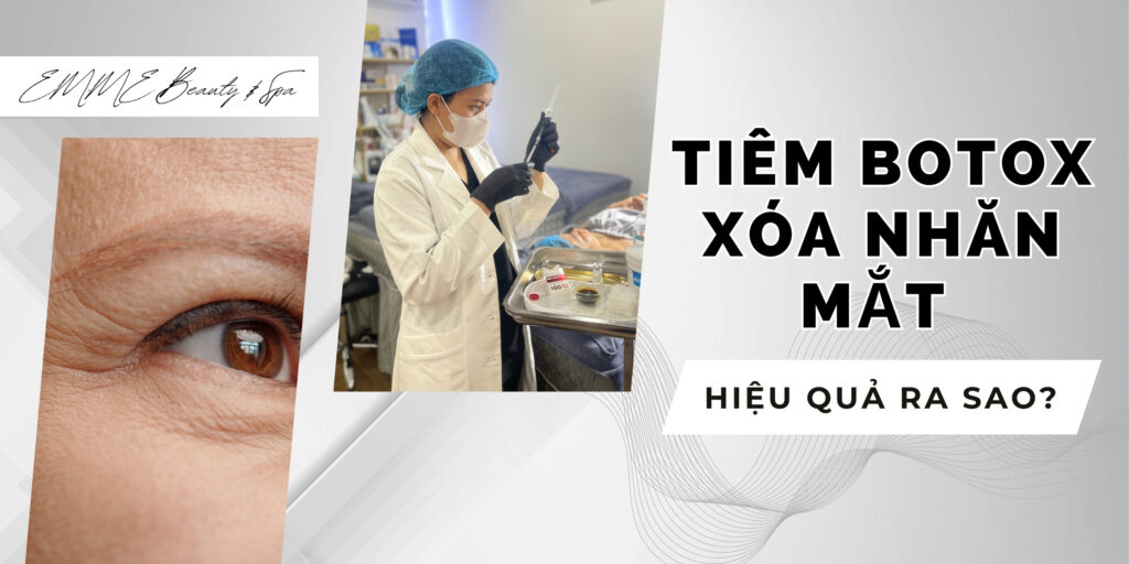 Tiêm botox xóa nhăn mắt có hiệu quả không thumb