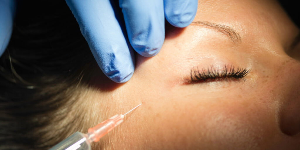 Tiêm botox xóa nhăn mắt giá bao nhiêu và hiệu quả ra sao? 2 Tiêm botox xóa nhăn mắt là gì