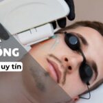 Triệt lông cho nam giới có làm mất đi vẻ nam tính không thumb