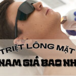 Triệt lông mặt vĩnh viễn cho nam giá bao nhiêu thumb