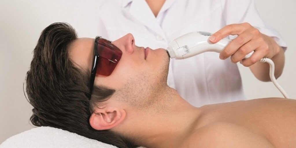 Triệt lông mặt vĩnh viễn cho nam giá bao nhiêu? Hướng dẫn chọn spa uy tín 5 Ưu điểm và nhược điểm khi triệt lông mặt vĩnh viễn cho nam