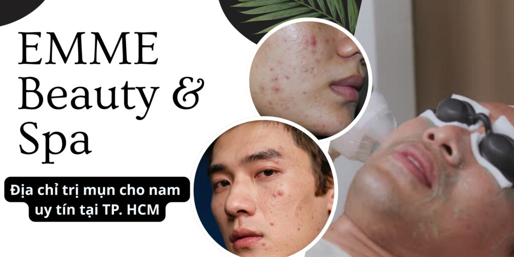 thumbnail Gợi ý spa trị mụn uy tín cho nam tại TP. HCM