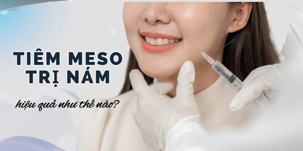 tiêm meso trị nám thumb