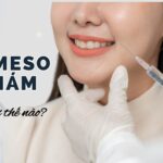 tiêm meso trị nám thumb